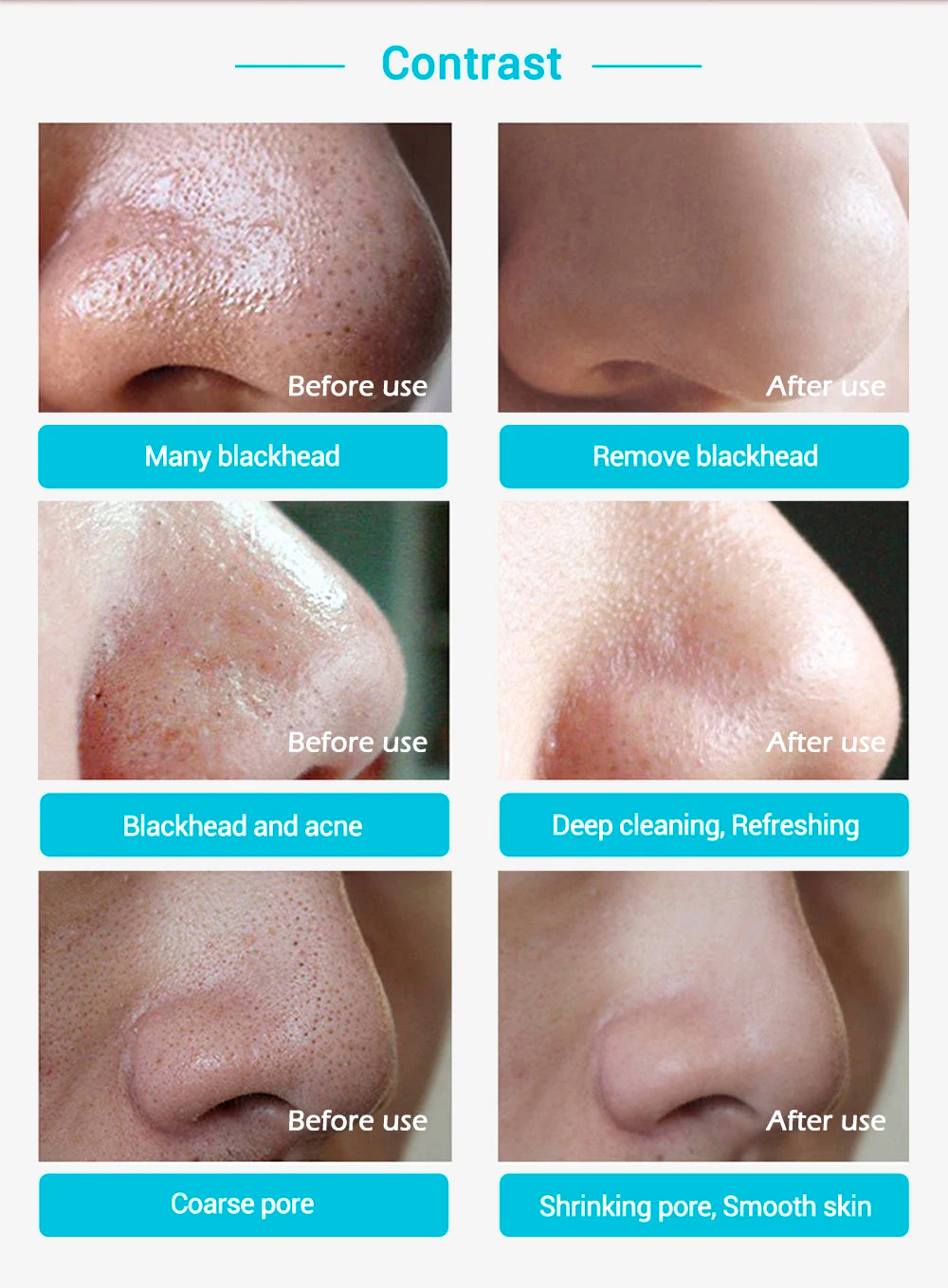 Blackhead Remover Nose Mask