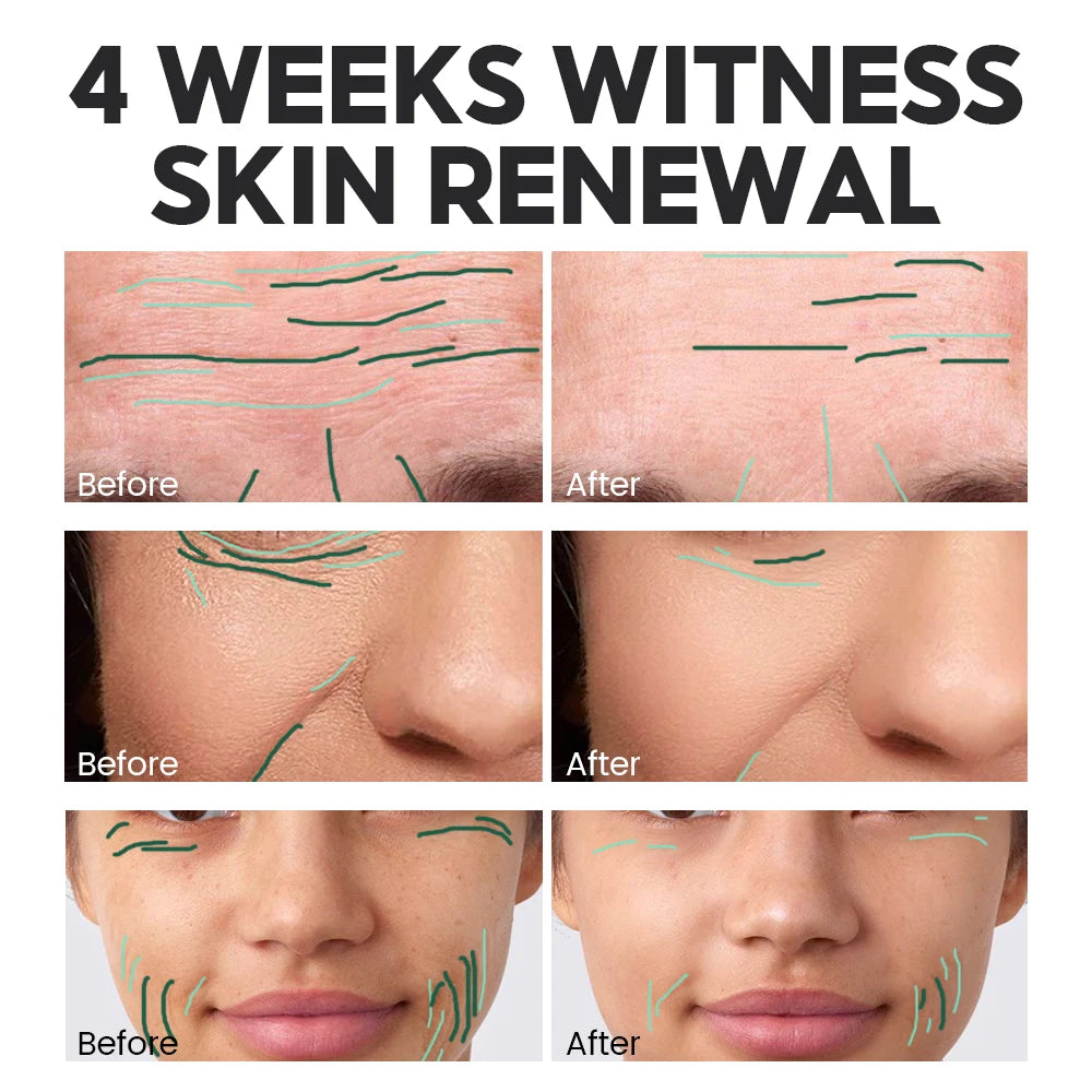 Retinol Face Cream and Serum Set