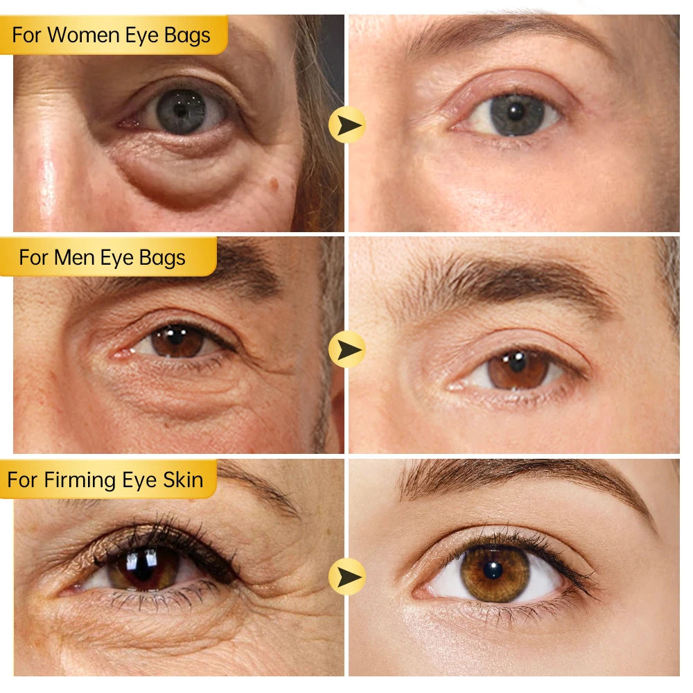 Peptide Dark Circles Removal Eye Cream