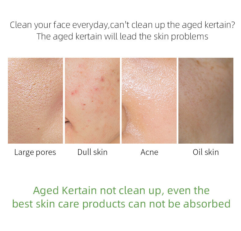 Face Scrub Peeling Gel