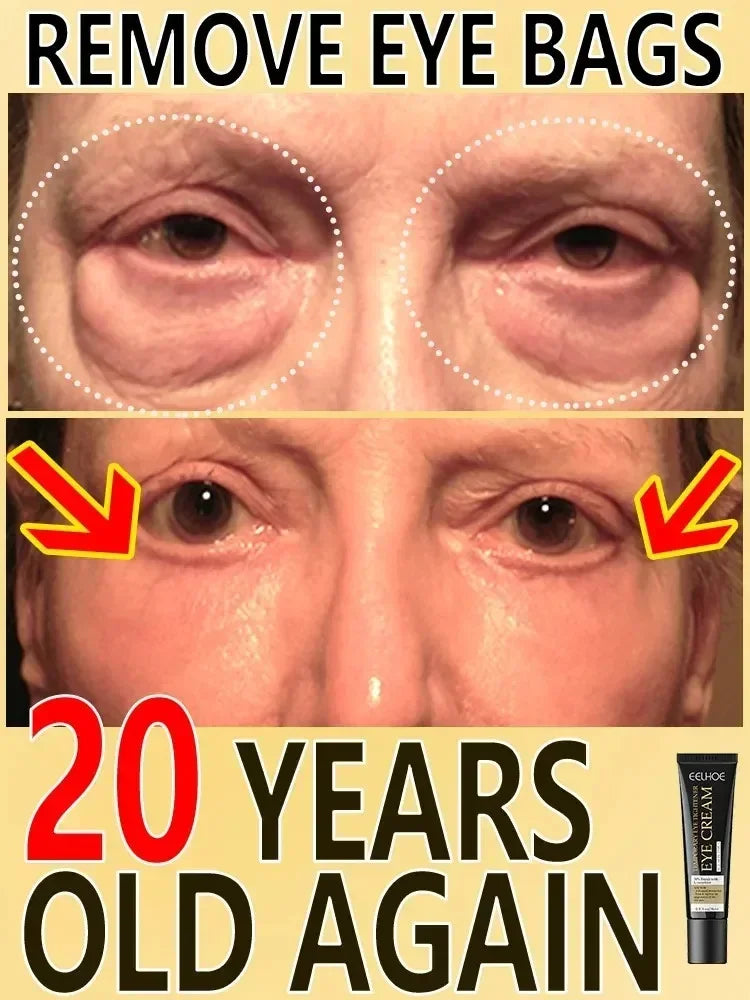 7-Day Wrinkle-Tightening Eye Cream