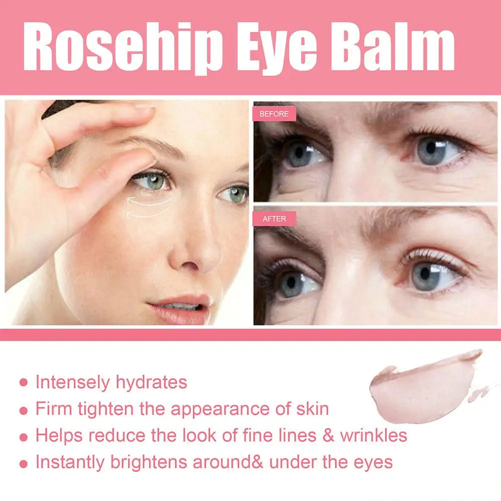 Women Extra Renewing Rosehip Eye Cream